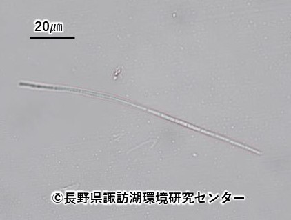 2024年度の諏訪湖の植物プランクトン調査結果がまとまりました